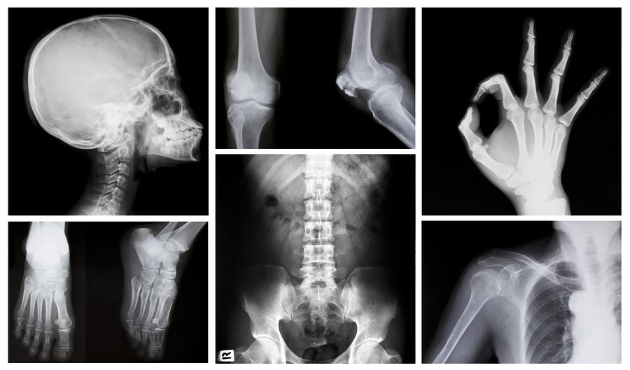 X ray Day 2017 Free Printable 2025 Calendar With Holidays