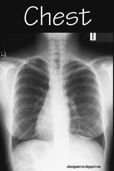 4x6 X ray Photos Print Them Laminate Them And Use Them
