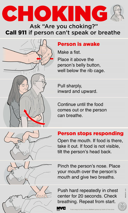 At 96 Dr Heimlich Uses His Own Maneuver On Choking 